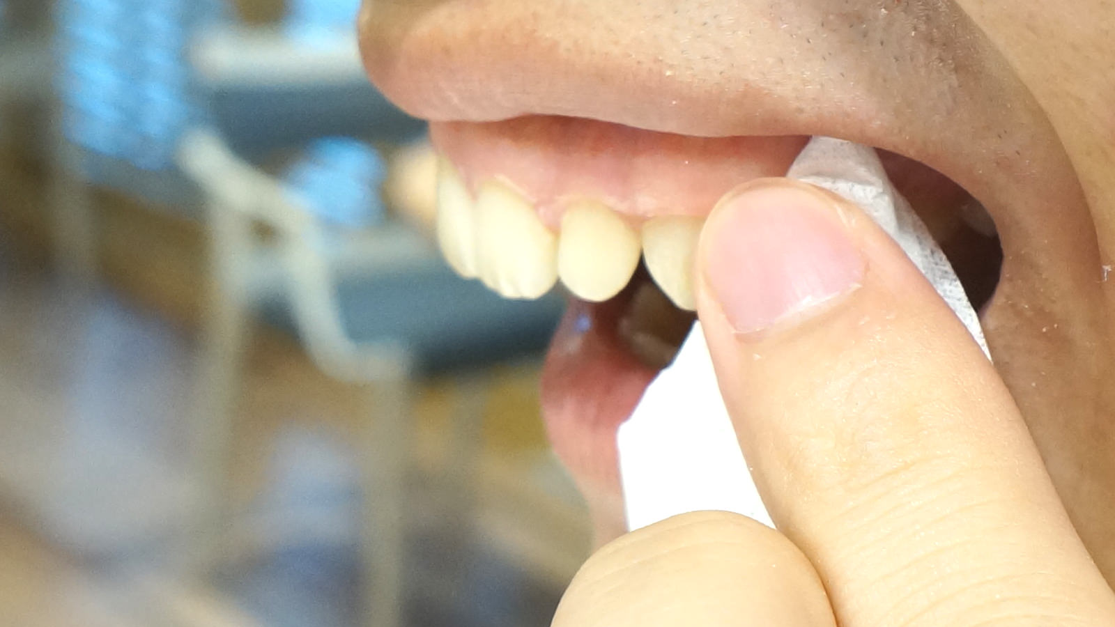 簡単に歯を白くする方法 簡単な裏ワザでホワイトニング!? 自分でできる、歯を白く健康的にみせる方法