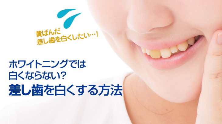 簡単に歯を白くする方法 歯を白くしたい！中学生でもできる自宅で歯を白くする方法とは？！