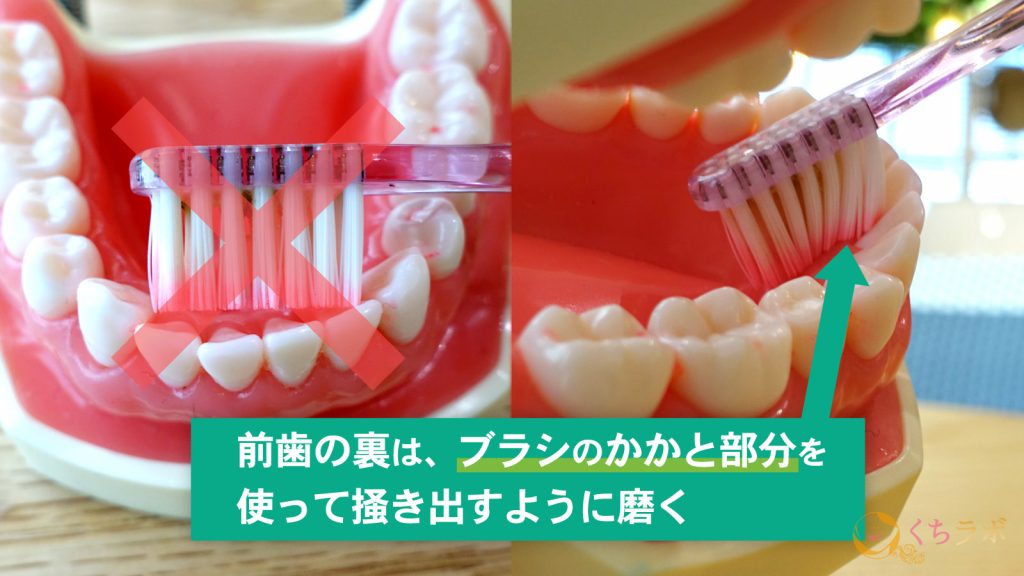 正しい歯の磨き方を知っていますか？