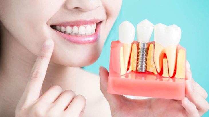 白い歯と歯の模型の画像